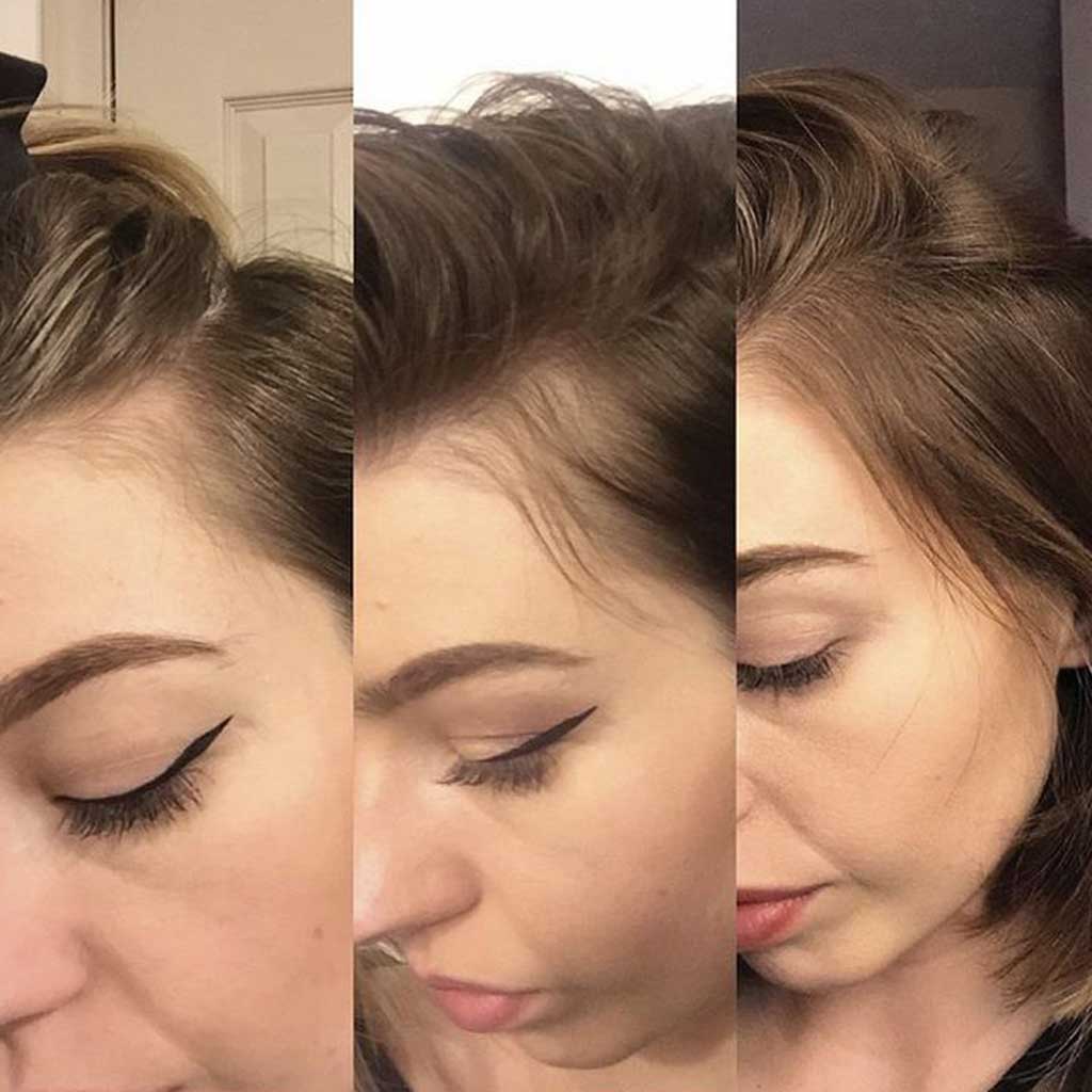 Have Hair Regrowing Spray